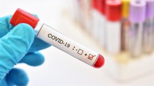 Covidi – 19 .  Νέα κρούσματα του ιού στην Π.Ε Λακωνίας 26.1.2021